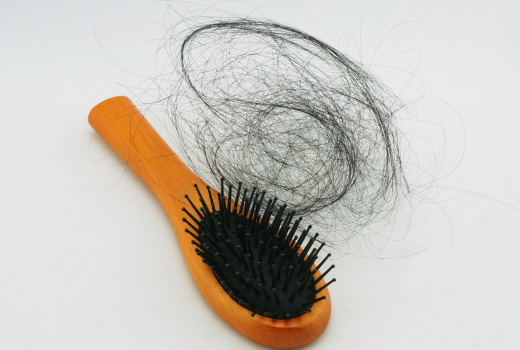 The Common Issue - Hairfall